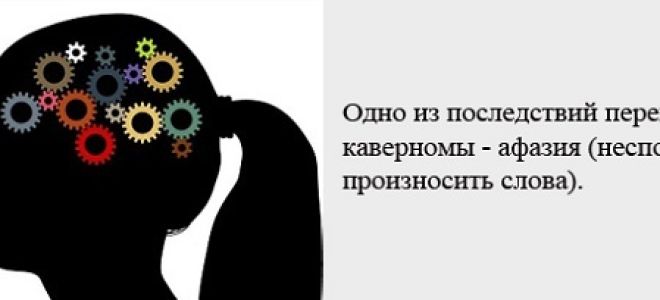 Кавернозная ангиома: симптомы, удаление, лечение и последствия