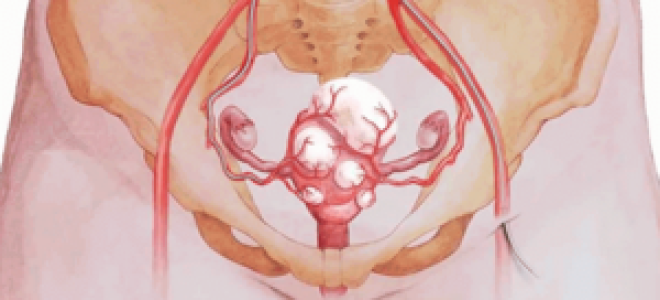 Миома матки при беременности: опасно ли для плода, влияние на плод и ребёнка