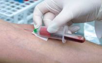 Какие показатели крови указывают на онкологию: анализ крови и расшифровка