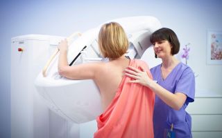 Рак молочной железы: симптомы, лечение, фото, причины и признаки на начальных стадиях