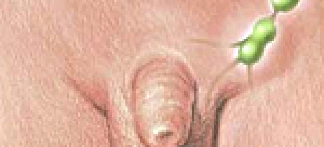 Подвздошные лимфоузлы: причины увеличения, норма, где находятся