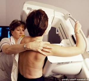 Рак молочной железы: симптомы, лечение, фото, причины и признаки на начальных стадиях