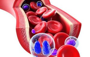 Лимфолейкоз: лечение, показатели анализа крови, симптомы, причины, стадии и продолжительность жизни