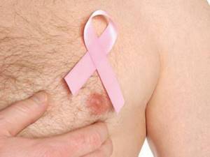 Рак груди у мужчин: симптомы, как распознать, причины, прогноз и лечение