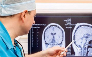 МР ангиография: как проводится, что показывает, подготовка к исследованию сосудов головного мозга