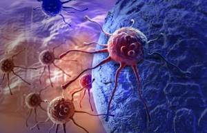 Иммунотерапия при меланоме: эффективность лечения