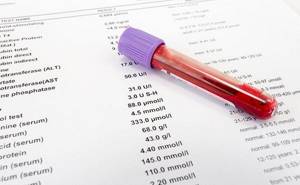 Анализ крови при лимфоме: показатели у взрослых и детей, диагностика