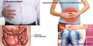 Тубулярная аденома толстой кишки: виды, симптомы и лечение