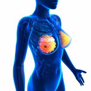 Профилактика рака молочной железы: факторы риска, первичная, вторичная, как защитить себя от рака