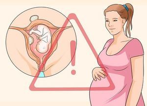 Миома матки при беременности: опасно ли для плода, влияние на плод и ребёнка