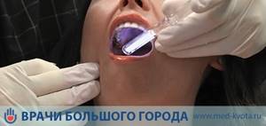 Рак полости рта: фото начальной стадии, симптомы, лечение и прогноз