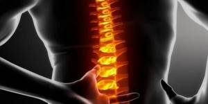 Опухоль спинного мозга: виды, симптомы, диагностика и лечение