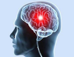 Гигрома головного мозга: виды, лечение, симптомы и причины