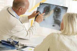 Химиотерапия при раке лёгких: как проводится, последствия и эффективность