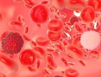Сколько живут с острым лейкозом крови: шанс выжить, лечится или нет