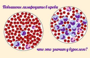 Лимфоциты повышены у женщины: причины, опасность, симптомами каких заболеваний является