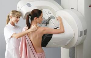 Сколько живут с раком груди: прогноз выживаемости при раке молочной железы