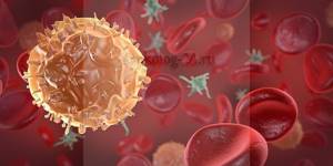 Моноцитарный лейкоз: симптомы, картина крови и прогноз жизни