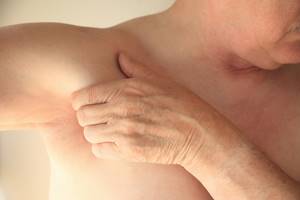 Воспаление лимфоузлов под мышкой у женщин и мужчин