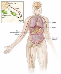 Рак поджелудочной железы 4 стадия: сколько живут с метастазами, методы лечения