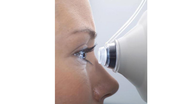 Флуоресцентная ангиография: как проводится исследование сетчатки глаза и глазного дна