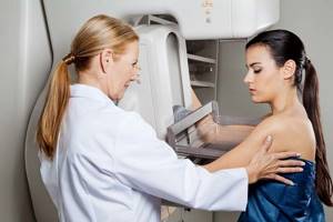 Инфильтративный рак молочной железы: типы, степени, симптомы, лечение и прогноз