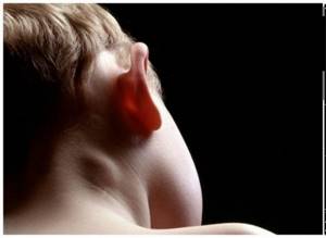 У ребёнка увеличены лимфоузлы на шее: причины, лечение, симптомами каких болезней является