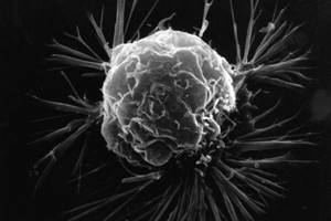 Раковые клетки: виды, как образуются, выглядят, чего боятся, причины появления и роста
