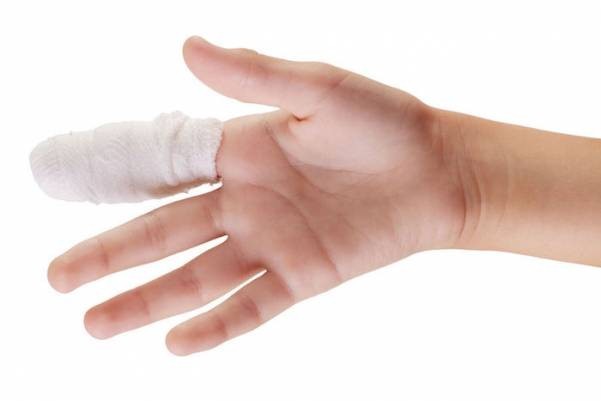 Гигрома на пальце руки: лечение, фото и удаление