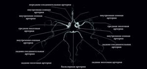 МР ангиография: как проводится, что показывает, подготовка к исследованию сосудов головного мозга