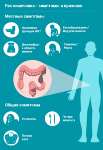 Рак кишечника: первые симптомы на ранних стадиях, лечение и прогноз