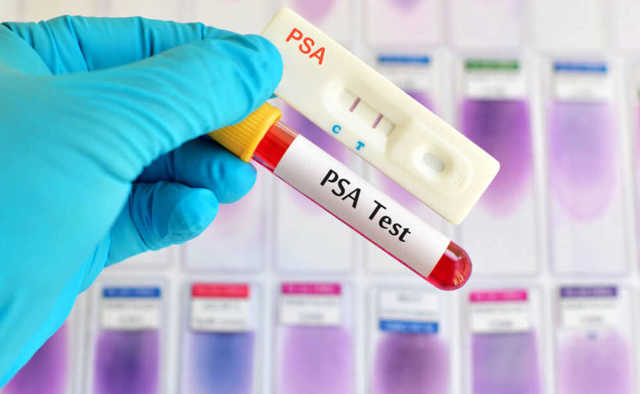 Тест на рак простаты: уровень ПСА, норма в анализе, показания
