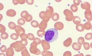 Нейтрофилы понижены, лимфоциты повышены: причины, о чём это говорит